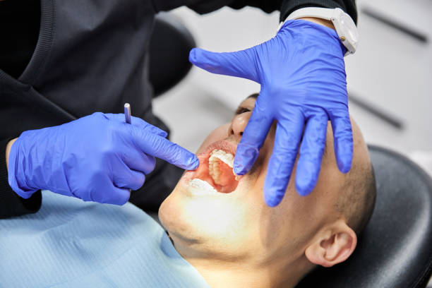 Best Tooth Infection Emergency Dentist  in Holly Lake Ranch, TX